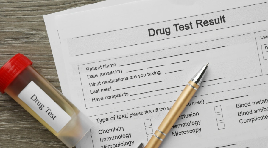 Image of drug test result form of workplace drug test