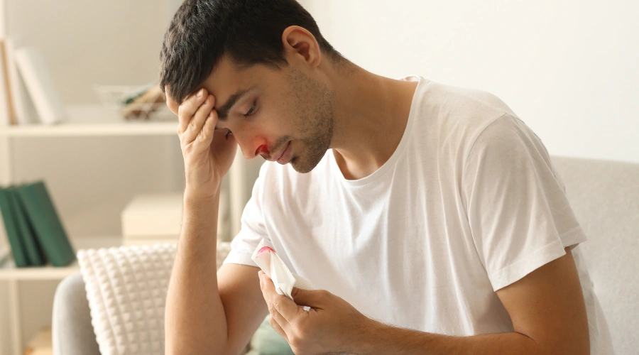 Image of nosebleed and nasal damage from chronic cocaine use