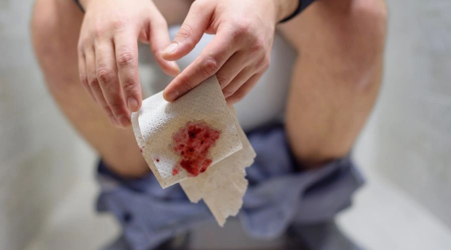 Image of a man sitting on a toilet holding blood-stained toilet paper in his hand - Can Alcohol Cause Bleeding in Stool - Ingrained Recovery
